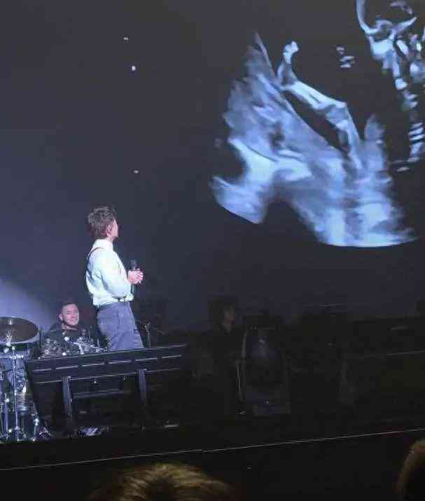 方力申回应“接受不了生女儿”风波：幽默翻车引发家庭与舆论双重压力