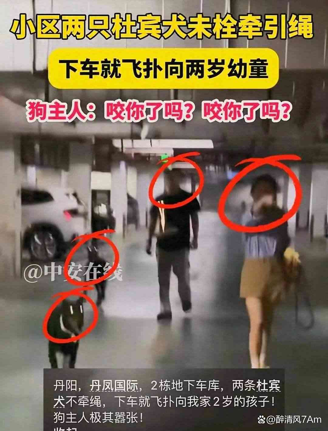 未拴绳杜宾犬扑向幼童引发众怒：文明养犬刻不容缓